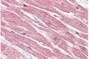Human Heart (formalin-fixed, paraffin-embedded) stained with BECN1 antibody ABIN461895 at 5 ug/ml followed by biotinylated goat anti-rabbit IgG secondary antibody ABIN481713, alkaline phosphatase-streptavidin and chromogen.