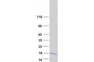 Validation with Western Blot (LARP6 Protein (Transcript Variant 2) (Myc-DYKDDDDK Tag))