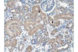 SSR1 antibody was used for immunohistochemistry at a concentration of 4-8 ug/ml. (SSR1 antibody)
