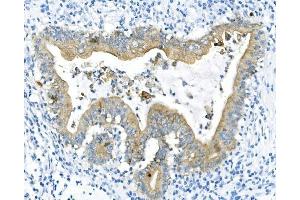 IHC analysis of Cytokeratin 8 using anti-Cytokeratin 8 antibody (ABIN6719478). (KRT8 antibody  (AA 107-325))