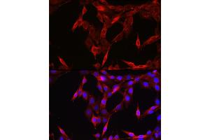 Immunofluorescence analysis of NIH/3T3 cells using ST Rabbit pAb (ABIN6128541, ABIN6148581, ABIN6148582 and ABIN6213980) at dilution of 1:200 (40x lens). (STAT6 antibody  (AA 1-180))