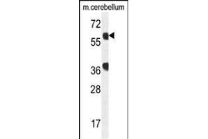 Western Blotting (WB) image for anti-GTP Binding Protein 2 (GTPBP2) (AA 536-564), (C-Term) antibody (ABIN654178)
