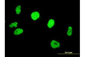 Immunofluorescence of purified MaxPab antibody to SMARCB1 on HeLa cell. (SMARCB1 antibody  (AA 1-385))