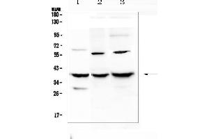 Western blot analysis of IGFBP2 using anti-IGFBP2 antibody (ABIN5693239).