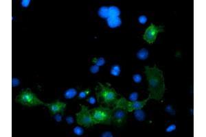 Anti-LRRC25 mouse monoclonal antibody (ABIN2455880) immunofluorescent staining of COS7 cells transiently transfected by pCMV6-ENTRY LRRC25 (RC209911). (LRRC25 antibody)