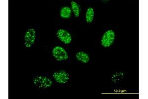 Immunofluorescence of purified MaxPab antibody to ELK4 on HeLa cell. (ELK4 antibody  (AA 1-405))