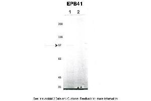 Lanes:   1. (EPB41 antibody  (N-Term))