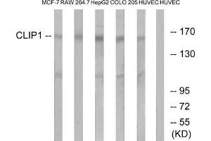 Western Blotting (WB) image for anti-CAP-GLY Domain Containing Linker Protein 1 (CLIP1) (C-Term) antibody (ABIN1850985) (CLIP1 antibody  (C-Term))