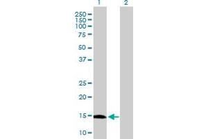 Western Blot analysis of GLIPR2 expression in transfected 293T cell line by GLIPR2 MaxPab polyclonal antibody. (GLIPR2 antibody  (AA 1-154))