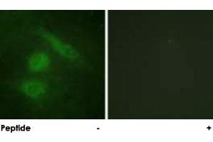 Immunofluorescence analysis of HeLa cells, using IRF3 polyclonal antibody .