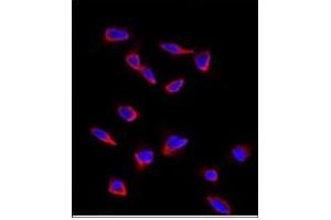 Image no. 3 for anti-SRY (Sex Determining Region Y)-Box 9 (SOX9) (N-Term) antibody (ABIN356879) (SOX9 antibody  (N-Term))