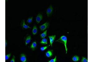 Immunofluorescent analysis of A549 cells using ABIN7164574 at dilution of 1:100 and Alexa Fluor 488-congugated AffiniPure Goat Anti-Rabbit IgG(H+L) (ZDHHC2 antibody  (AA 75-130))