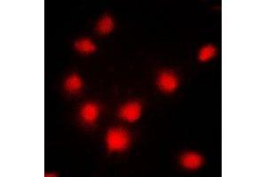 Immunofluorescent analysis of BRCA1 staining in MCF7 cells. (BRCA1 antibody  (C-Term))