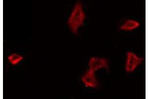 ABIN6266644 staining HeLa by IF/ICC. (PAR1 antibody  (N-Term))