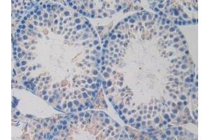 Detection of LOX1 in Mouse Testis Tissue using Polyclonal Antibody to Lectin Like Oxidized Low Density Lipoprotein Receptor 1 (LOX1) (OLR1 antibody  (AA 60-312))