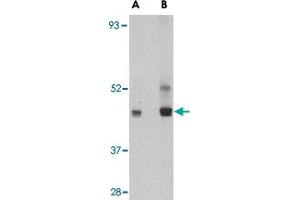 Western blot analysis of PAFAH1B1 in HeLa cell lysate with PAFAH1B1 polyclonal antibody  at (A) 0. (PAFAH1B1 antibody  (C-Term))