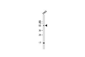 Anti-FUT6 Antibody (Center) at 1:1000 dilution + Hela whole cell lysate Lysates/proteins at 20 μg per lane. (FUT6 antibody  (AA 102-130))