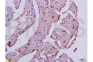 Immunohistochemistry (IHC) image for anti-Desmin (DES) (AA 261-360) antibody (ABIN736566)