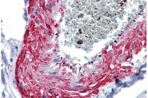 Human Vessel: Formalin-Fixed, Paraffin-Embedded (FFPE) (MYOC antibody  (AA 36-135))