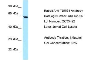Western Blotting (WB) image for anti-Transforming Growth Factor beta Regulator 4 (TBRG4) (N-Term) antibody (ABIN971851) (TBRG4 antibody  (N-Term))