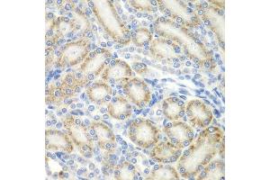 Immunohistochemistry of paraffin-embedded rat kidney using ASPSCR1 antibody. (ASPSCR1 antibody  (AA 284-553))