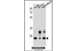 Western blot analysis in HL-60,ZR-75-1,MDA-MB453 cell line lysates (35ug/lane). (GFRA4 antibody  (AA 156-184))