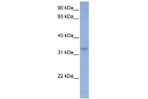 WB Suggested Anti-DAZL Antibody Titration:  0. (DAZL antibody  (C-Term))