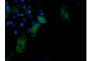 Image no. 3 for anti-Phosphoinositide-3-Kinase, Regulatory Subunit 5 (PIK3R5) antibody (ABIN1500214) (PIK3R5 antibody)