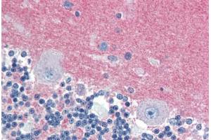 Human Brain, Cerebellum (formalin-fixed, paraffin-embedded) stained with RAB3A antibody ABIN462094 at 10 ug/ml followed by biotinylated goat anti-rabbit IgG secondary antibody ABIN481713, alkaline phosphatase-streptavidin and chromogen. (RAB3A antibody  (AA 202-217))
