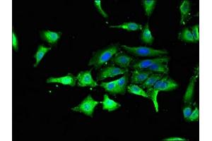 Immunofluorescent analysis of Hela cells using ABIN7154214 at dilution of 1:100 and Alexa Fluor 488-congugated AffiniPure Goat Anti-Rabbit IgG(H+L) (GSK3 alpha antibody  (AA 36-118))