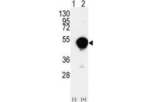 Western Blotting (WB) image for anti-Cytochrome P450, Family 20, Subfamily A, Polypeptide 1 (CYP20A1) antibody (ABIN3003220)