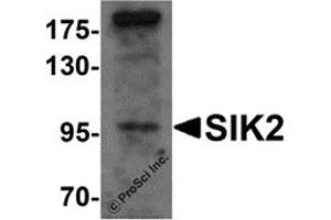 Western Blotting (WB) image for anti-Salt-Inducible Kinase 2 (SIK2) (Middle Region) antibody (ABIN1031093) (SIK2 antibody  (Middle Region))