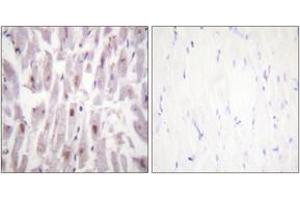 Immunohistochemistry analysis of paraffin-embedded human heart, using PPAR-BP (Phospho-Thr1457) Antibody. (PPAR-BP (AA 1423-1472), (pThr1457) antibody)