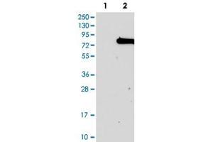 Western blot analysis of Lane 1: Negative control (vector only transfected HEK293T lysate), Lane 2: Over-expression Lysate (Co-expressed with a C-terminal myc-DDK tag (~3. (KIAA0020 antibody)