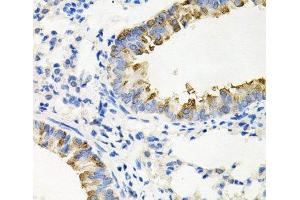 Immunohistochemistry of paraffin-embedded Mouse lung using IRAK2 Polyclonal Antibody at dilution of 1:100 (40x lens). (IRAK2 antibody)