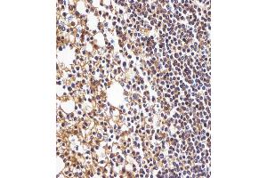 (ABIN1944779 and ABIN2838521) staining HLA-B in human tonsil tissue sections by Immunohistochemistry (IHC-P - paraformaldehyde-fixed, paraffin-embedded sections).