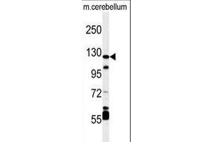 Western Blotting (WB) image for anti-Hypoxia Inducible Factor 1, alpha Subunit (Basic Helix-Loop-Helix Transcription Factor) (HIF1A) (AA 728-757), (C-Term) antibody (ABIN392176)
