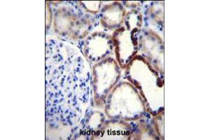 NKD2 Antibody immunohistochemistry analysis in formalin fixed and paraffin embedded human kidney tissue followed by peroxidase conjugation of the secondary antibody and DAB staining. (NKD2 antibody  (C-Term))