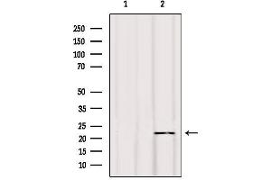 Western Blotting (WB) image for anti-BCL2-Interacting Killer (Apoptosis-Inducing) (BIK) antibody (ABIN6260261)
