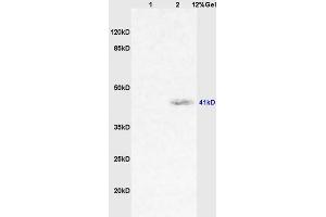 Lane 1: rat lung lysates Lane 2: human colon carcinoma lysates probed with Anti CD64/IGFR1/FCGR1A Polyclonal Antibody, Unconjugated (ABIN747413) at 1:200 in 4 °C. (FCGR1A antibody  (AA 101-200))