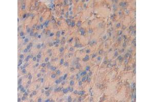 Used in DAB staining on fromalin fixed paraffin- embedded pancreas tissue (INSRR antibody  (AA 1067-1296))