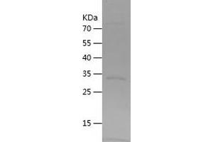 Western Blotting (WB) image for Enoyl-CoA Delta Isomerase 1 (ECI1) (AA 42-302) protein (His tag) (ABIN7122794) (DCI Protein (AA 42-302) (His tag))