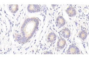 Detection of MMP13 in Porcine Uterus Tissue using Polyclonal Antibody to Matrix Metalloproteinase 13 (MMP13) (MMP13 antibody  (AA 123-270))