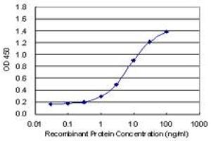 Detection limit for recombinant GST tagged SMAD7 is 0. (SMAD7 antibody  (AA 160-260))