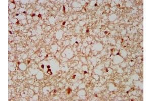 IHC image of ABIN7152338 diluted at 1:500 and staining in paraffin-embedded human brain tissue performed on a Leica BondTM system. (SERF2 antibody  (AA 107-224))