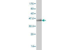 Western Blot detection against Immunogen (36. (FBXO7 antibody  (AA 357-455))