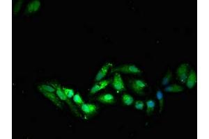 Immunofluorescent analysis of HepG2 cells using ABIN7171009 at dilution of 1:100 and Alexa Fluor 488-congugated AffiniPure Goat Anti-Rabbit IgG(H+L) (SOCS7 antibody  (AA 6-165))