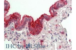 IHC-P analysis of Human Lung Tissue, with HE staining. (SCGB1A1 antibody  (AA 23-91))