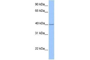 ZNF385D antibody used at 0. (ZNF385D antibody  (N-Term))