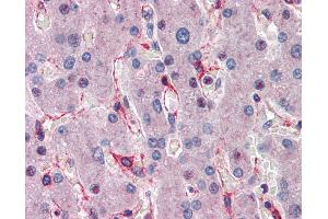Immunohistochemistry (IHC) image for anti-E3 Ubiquitin-Protein Ligase SIAH1 (SIAH1) (C-Term) antibody (ABIN2780459) (SIAH1 antibody  (C-Term))